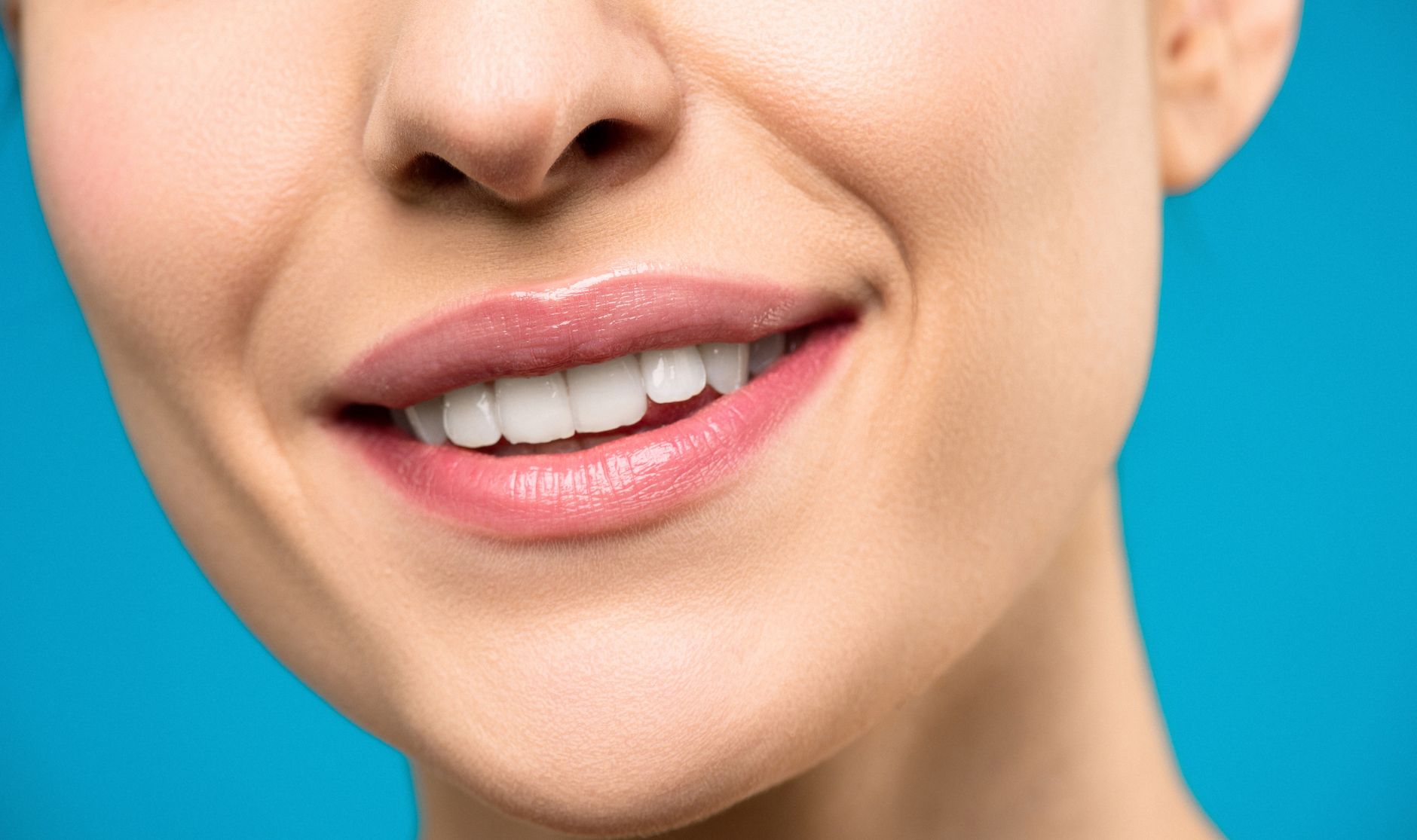 Clareamento dental profissional